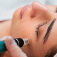 Hydrafacial
